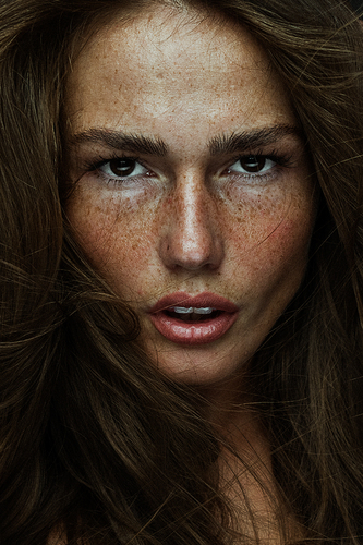 Freckles beauty 2