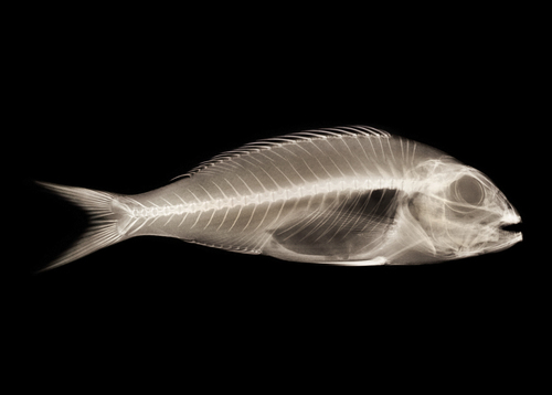 X ray fish