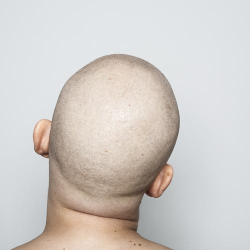 Head (of a Woman)