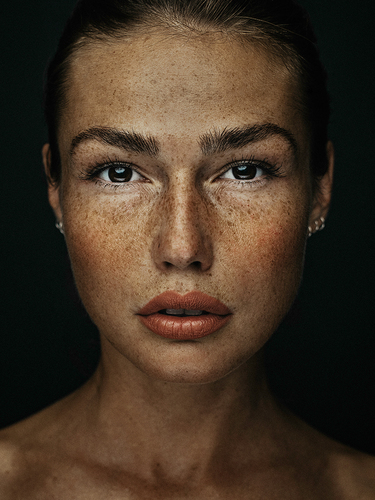 Freckles beauty