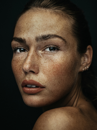 Freckles Romana #1