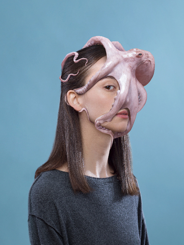 Nasal congestion 