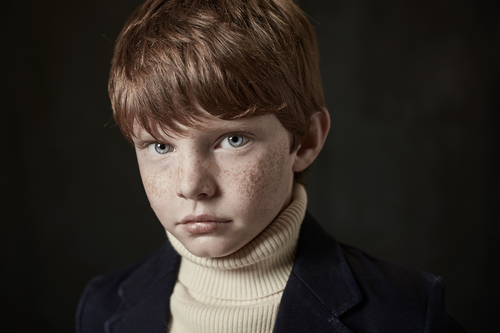 Freckles