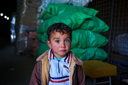 A Child with One Eye Blue
