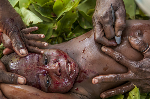 Scarification