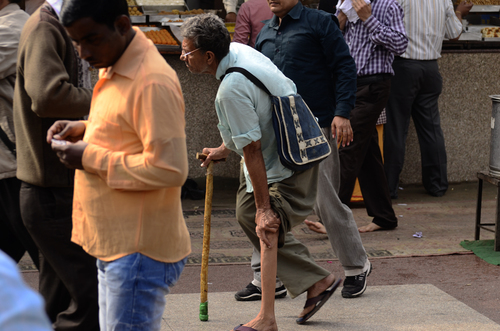 Prosthesis