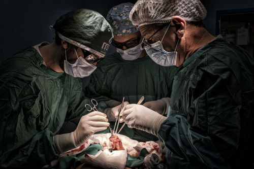 Anastomosis