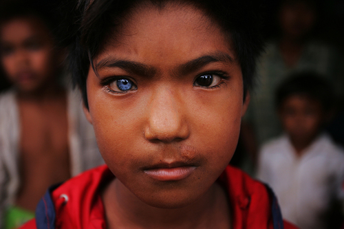 Blue Eyed Brown Eyed Boy