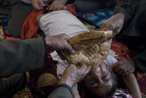 Circumcisions