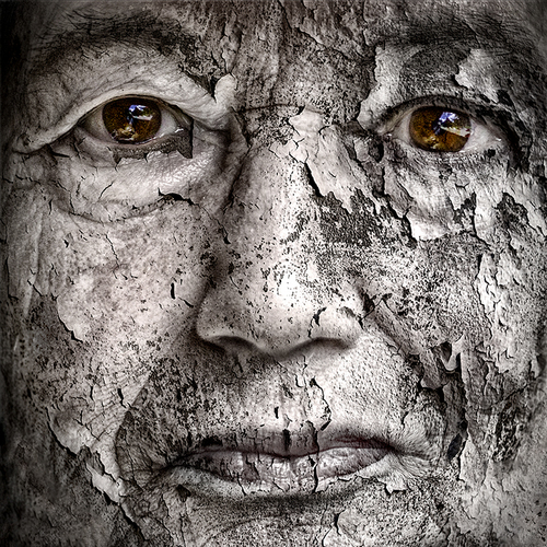 Age