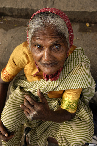 Leprous Woman