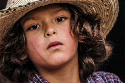 Child with Scar, Mexico