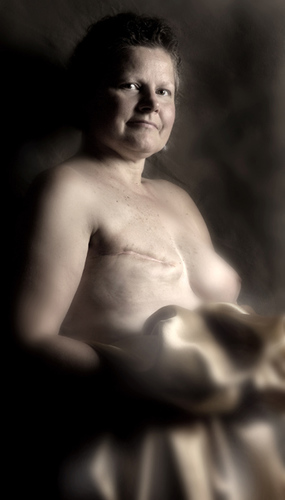 Cancer Patient