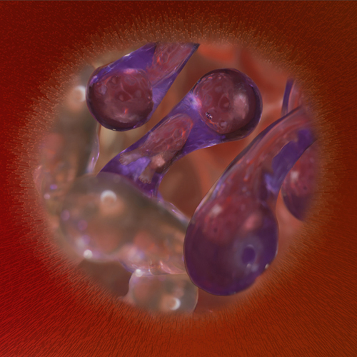 Abnormal Quadruplet Fetal Sonogram Abnormal Quadruplet Fetal Sonogram
