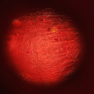 Endoscopy of Mars Color Awards Winners and Nominees