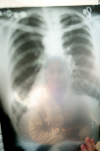 TB Patient  Kathmandu, Nepal