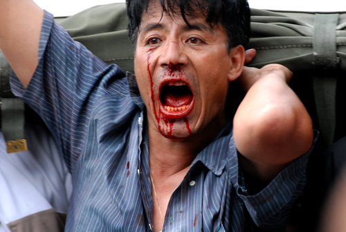 Tibetan Protest in Nepal, blood from mouth
