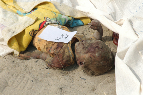 Child Killed by Bom Bom Blast