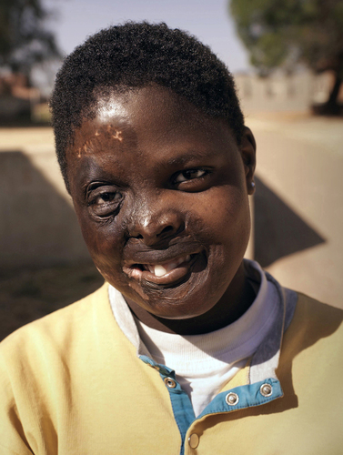 Teenager in a Soweto Orphanage