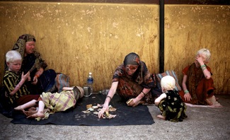 A hard life for Albino's in India Color Awards Winners and Nominees