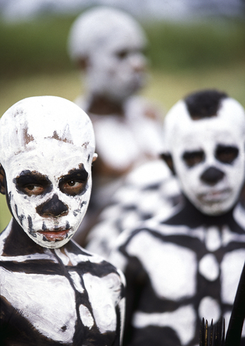 sckeleton child in Mount Hagen sckeleton child in Mount Hagen
