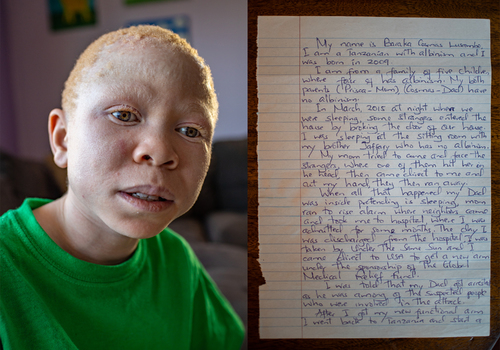 Constant Fear of Death: Growing up with Albinism