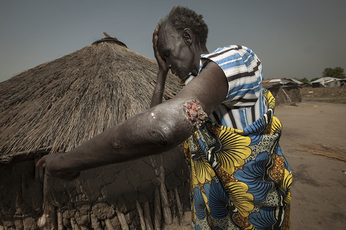 Counting the Cost of War in Bor, South Sudan