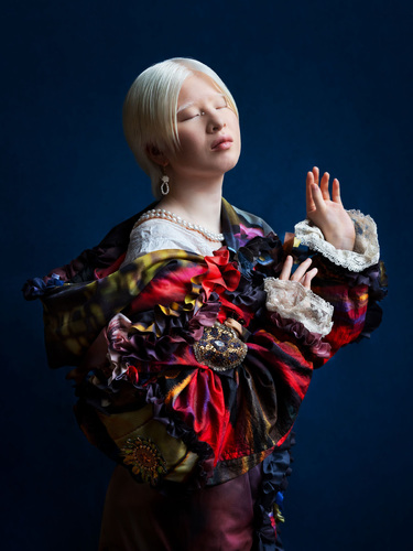 Veil of Light - The delicate resilience of albinism Veil of Light - The delicate resilience of albinism